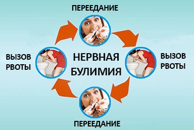 Лечение булимии в Средней Ахтубе